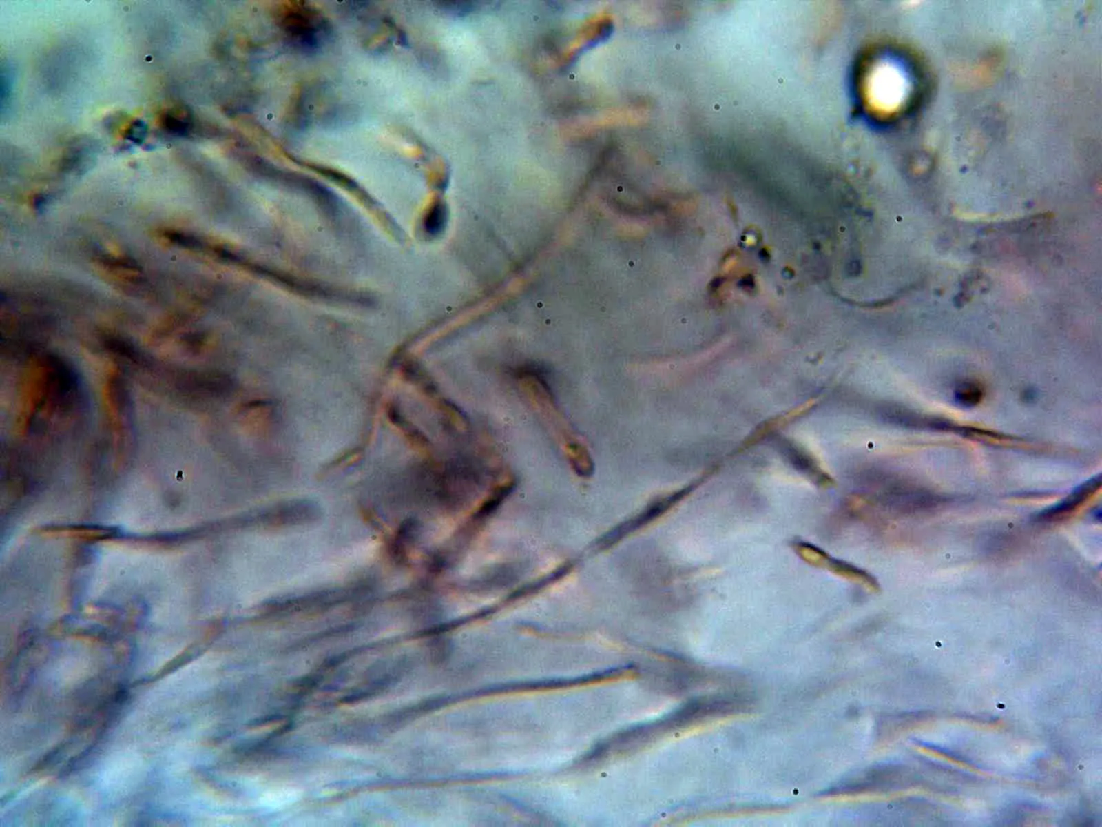 Microscopía de Russula cyanoxantha - 12 - Cutícula 2